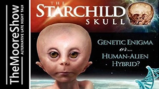 Lloyd Pye Interview on The Starchild Skull and Conehead | Podcast #164