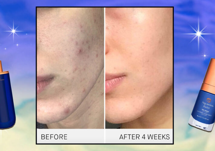 What’s Actually in the Cult-Fave Creams of This Stem Cell Doc’s Skincare?