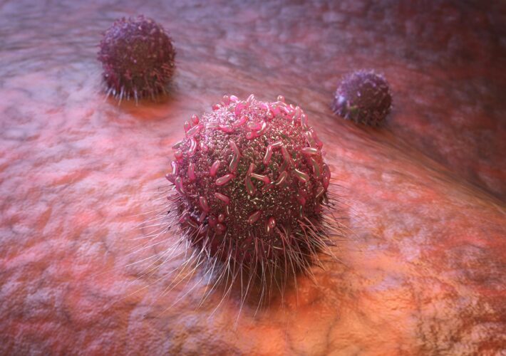 Turning Cancer Cells Into Normal Cells