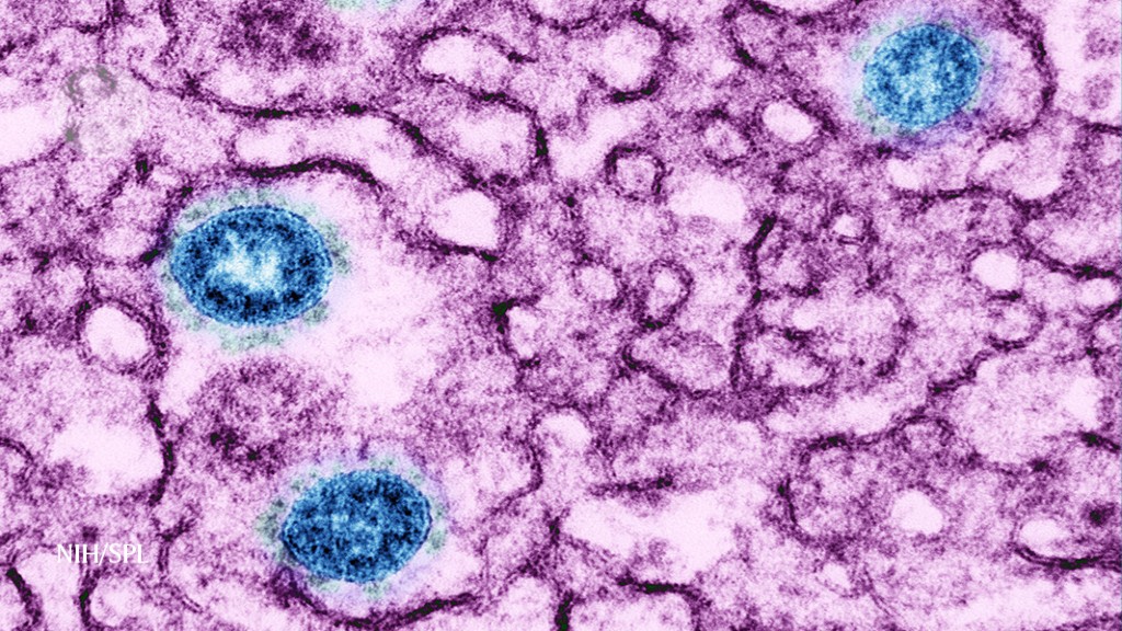Could long Covid be linked to herpes viruses? Early data offer a hint Could long Covid be linked to herpes viruses? Early data offer a hint